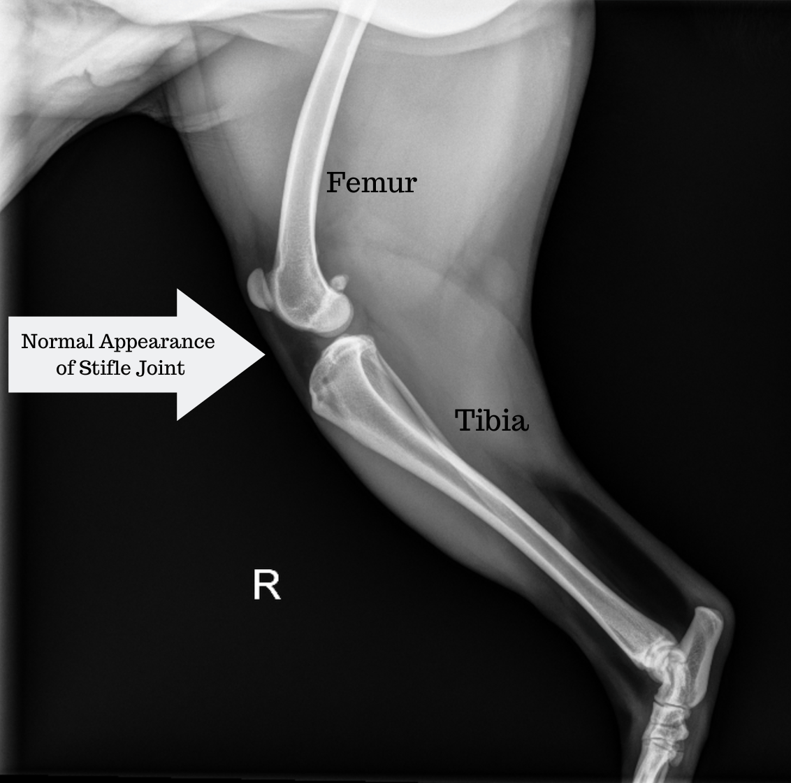 Right Leg X-ray