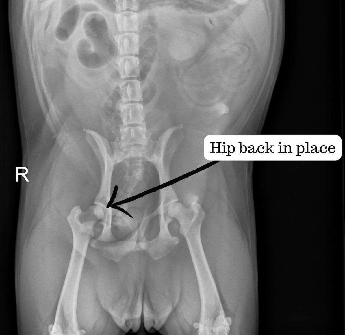 Xray after putting bone in place