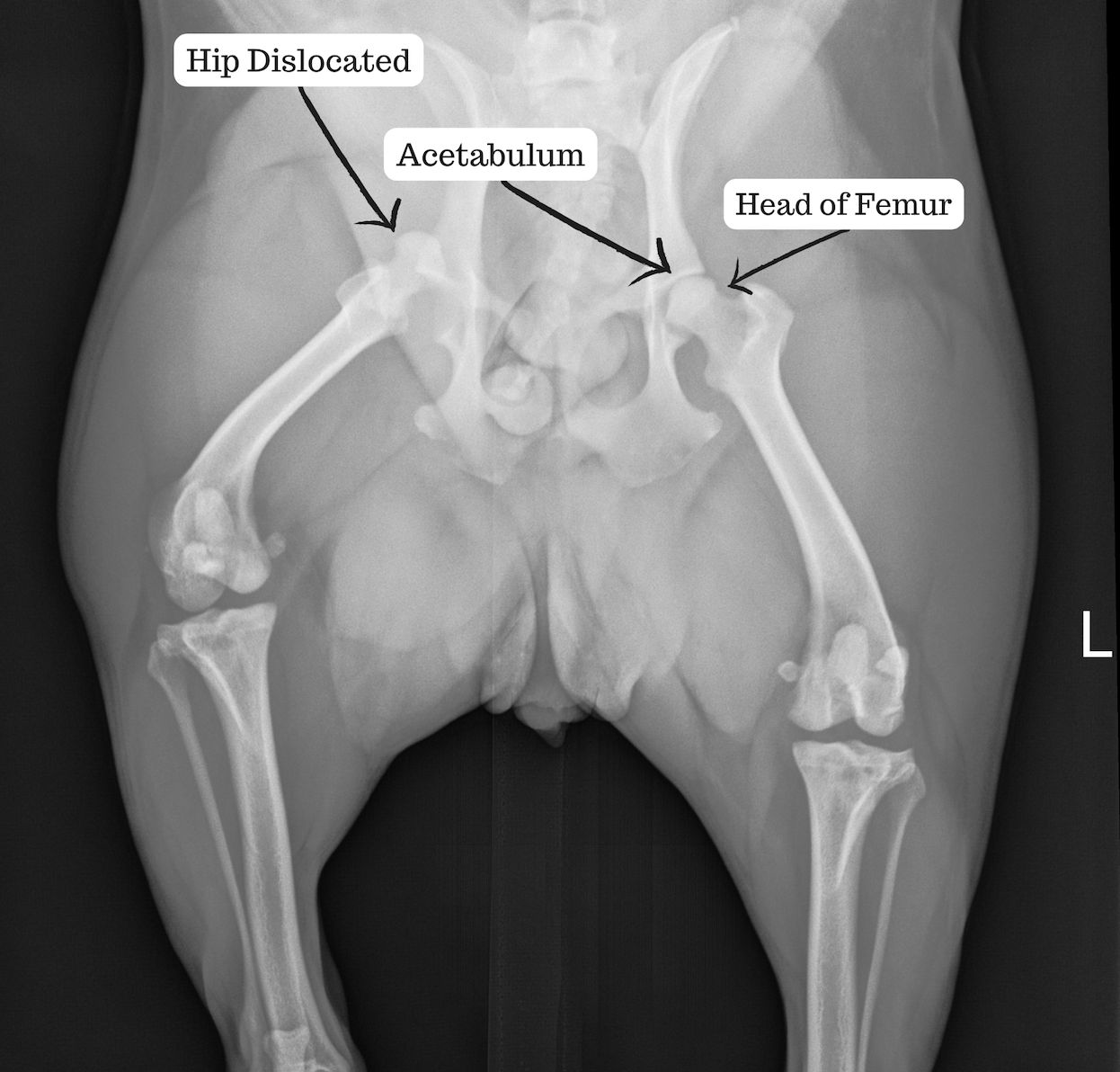 Xray of dislocated bone
